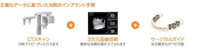 正確なデータに基づいた当院のインプラント手術画像