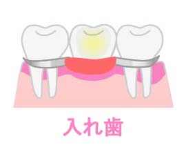 入れ歯画像